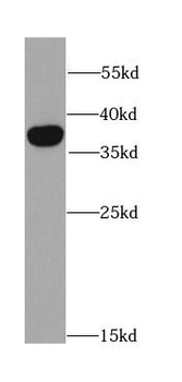 DKK3 Antibody