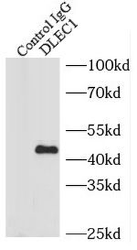 DLEC1 Rabbit Polyclonal Antibody