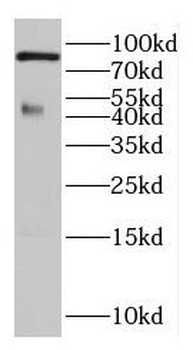 DLEC1 Rabbit Polyclonal Antibody