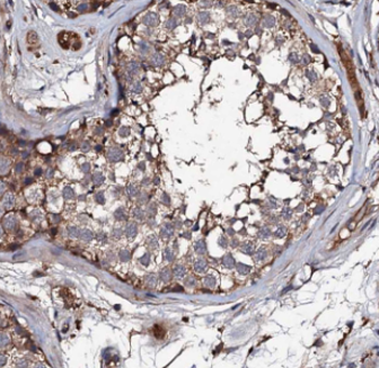 DLEC1 Rabbit Polyclonal Antibody