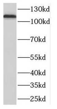 DLGAP3 Rabbit Polyclonal Antibody