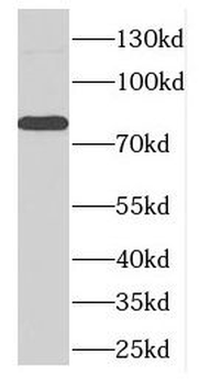 DLL4 Rabbit Polyclonal Antibody
