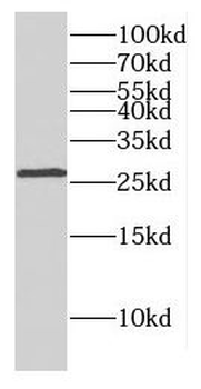 DLX1 Rabbit Polyclonal Antibody