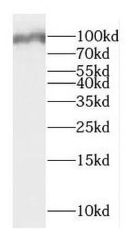 DMGDH Rabbit Polyclonal Antibody