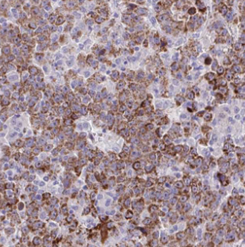 DMGDH Rabbit Polyclonal Antibody