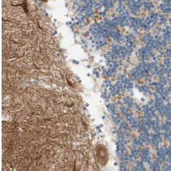 DMXL2 Rabbit Polyclonal Antibody
