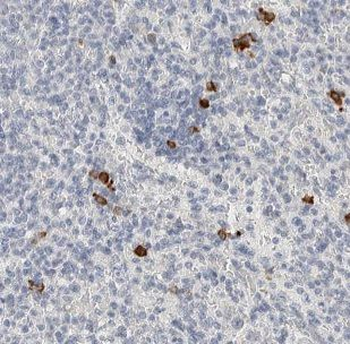 LIG1 Rabbit Polyclonal Antibody