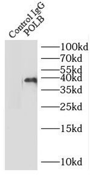 POLB Rabbit Polyclonal Antibody