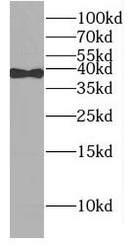 POLB Rabbit Polyclonal Antibody