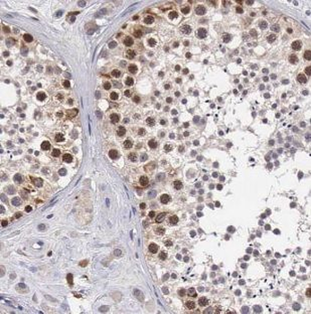 POLB Rabbit Polyclonal Antibody