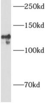 DNA2 Rabbit Polyclonal Antibody