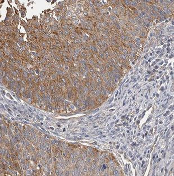 DNA2 Rabbit Polyclonal Antibody
