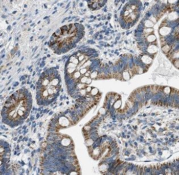 DNAH6 Rabbit Polyclonal Antibody