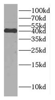 DNAJB11 Antibody