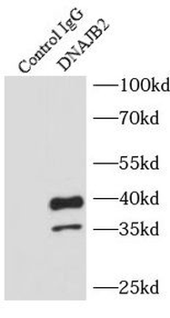 DNAJB2 Rabbit Polyclonal Antibody