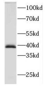 DNAJB2 Rabbit Polyclonal Antibody