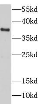 DNAJB4 Rabbit Polyclonal Antibody