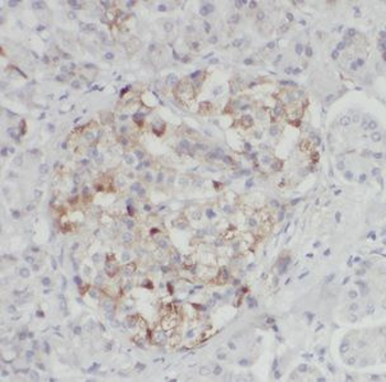 DNAJC10 Antibody