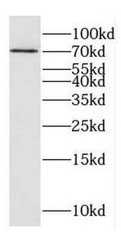 DNAJC21 Rabbit Polyclonal Antibody