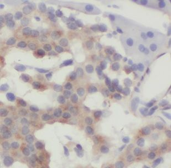 DNAJC21 Rabbit Polyclonal Antibody