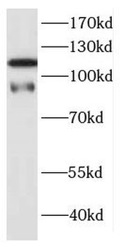 DNAJC6 Rabbit Polyclonal Antibody