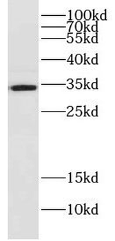DNAJC9 Antibody