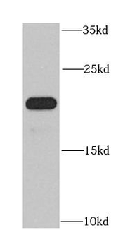 DNAL1 Rabbit Polyclonal Antibody