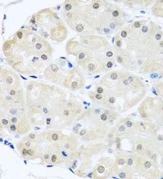 DNAL1 Rabbit Polyclonal Antibody
