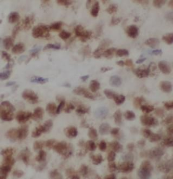 DNMT1 Antibody