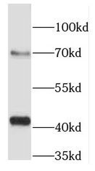 DNMT3L Rabbit Polyclonal Antibody