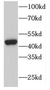 DOC2B Rabbit Polyclonal Antibody