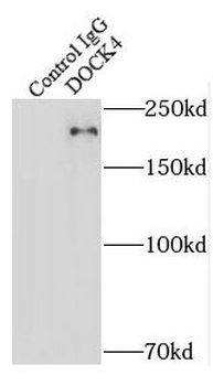DOCK4 Rabbit Polyclonal Antibody