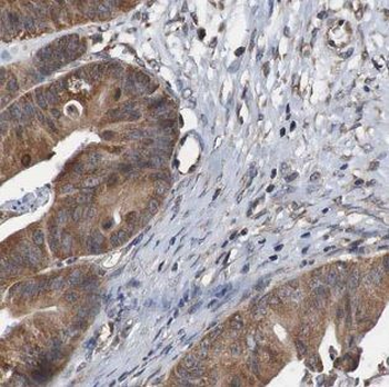 DOCK4 Rabbit Polyclonal Antibody