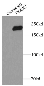 DOCK7 Rabbit Polyclonal Antibody