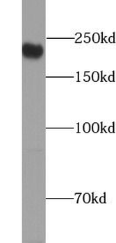 DOCK7 Rabbit Polyclonal Antibody