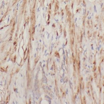 DOK4 Rabbit Polyclonal Antibody