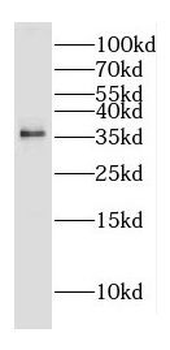 DOK5 Rabbit Polyclonal Antibody