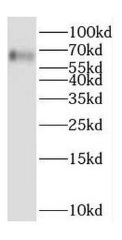 DOK7 Rabbit Polyclonal Antibody