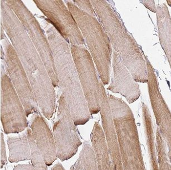 DOK7 Rabbit Polyclonal Antibody