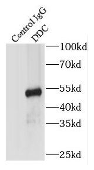 DDC Rabbit Polyclonal Antibody