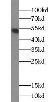 DDC Rabbit Polyclonal Antibody