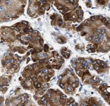 DDC Rabbit Polyclonal Antibody