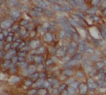 DBH Rabbit Polyclonal Antibody