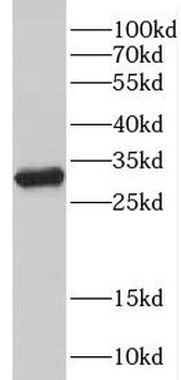 DPM1 Rabbit Polyclonal Antibody