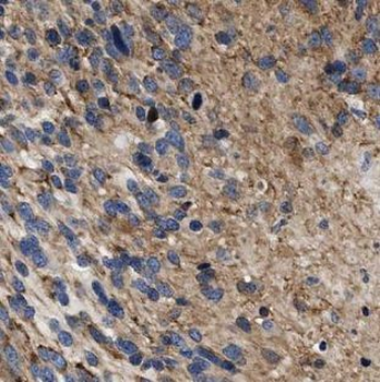 DPM1 Rabbit Polyclonal Antibody