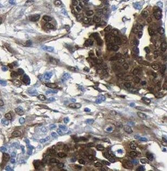DPP9 Rabbit Polyclonal Antibody