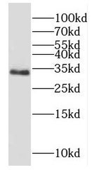 DPPA2 Rabbit Polyclonal Antibody