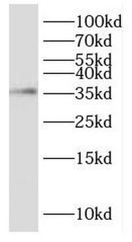 DPPA4 Rabbit Polyclonal Antibody