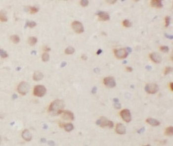 DRD2 Rabbit Polyclonal Antibody