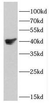 DSN1 Rabbit Polyclonal Antibody
